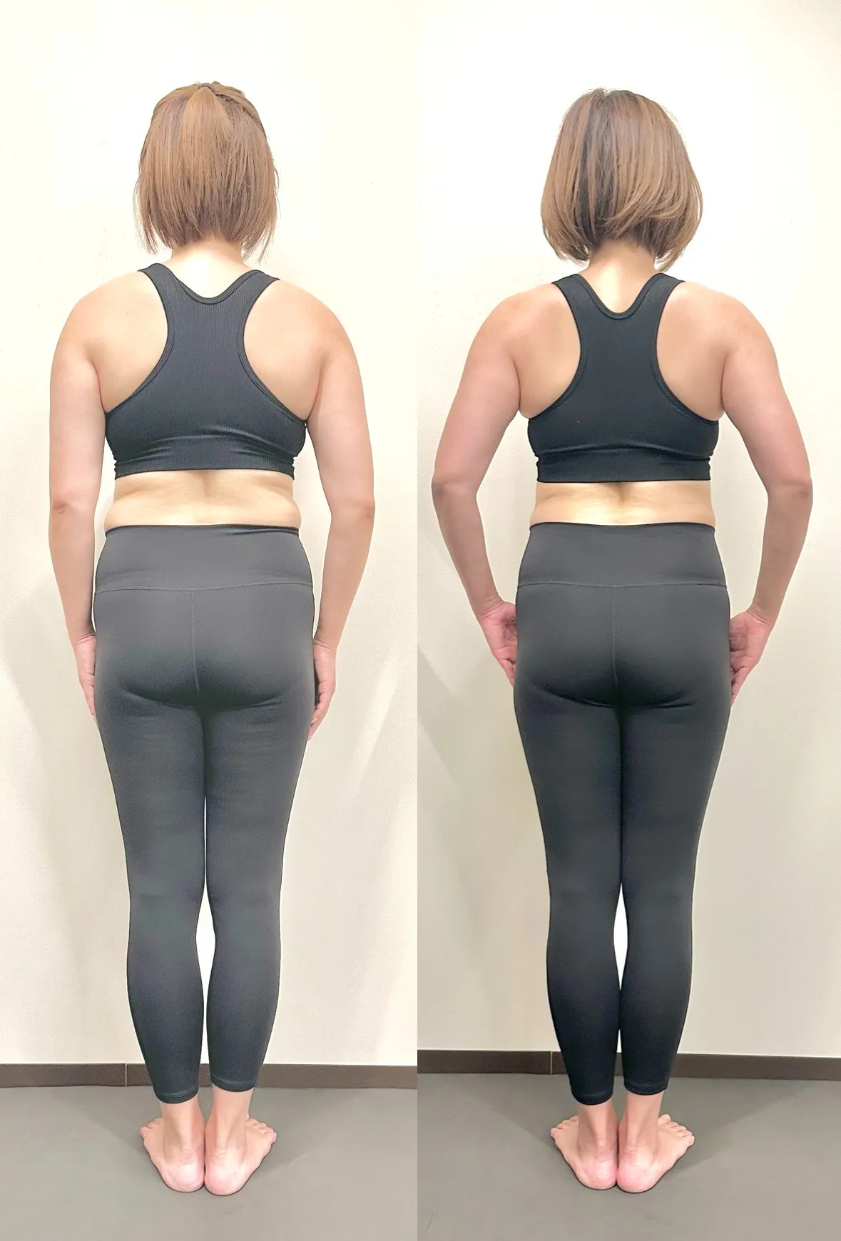 M.T 様 50代 女性